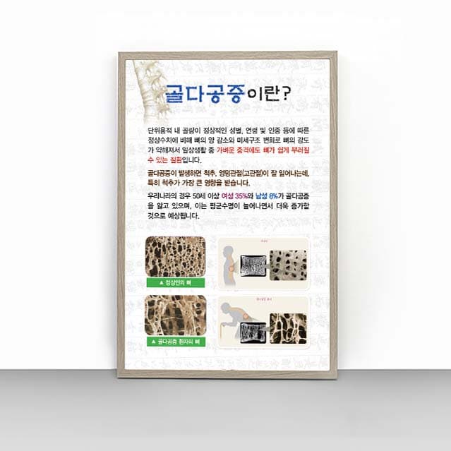 [L4-018]골다공증이란?